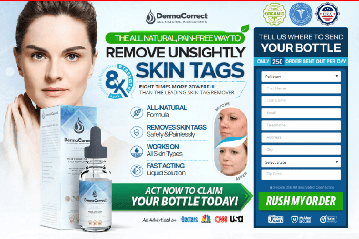 Derma Correct Skin Tag removal