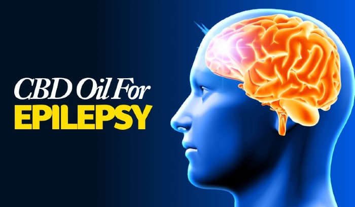 CBD For Epilepsy